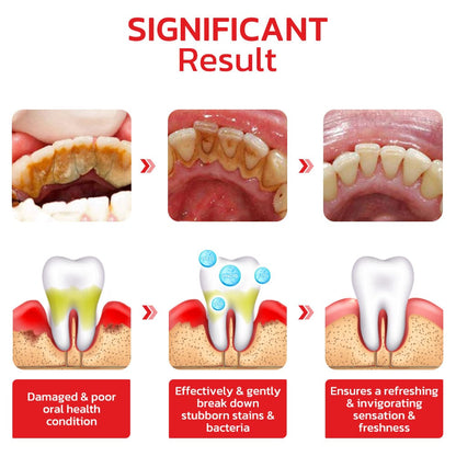 Originalโข SP4 Ultra Teeth Whitening Toothpaste