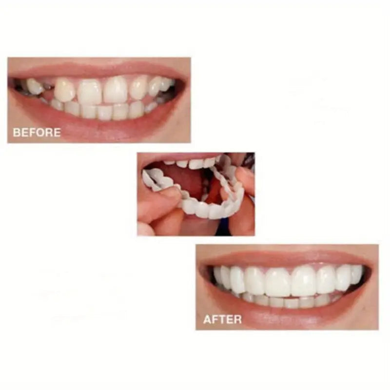 SmileSetโข